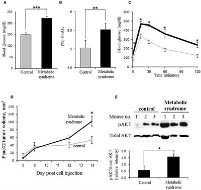 Regulation of Heparanase in Diabetes-Associated Pancreatic Carcinoma